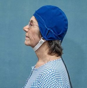 Female research participant wearing the MemorEM electromagnetic skullcap